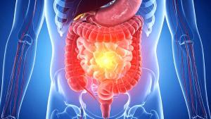 small intestine cancer