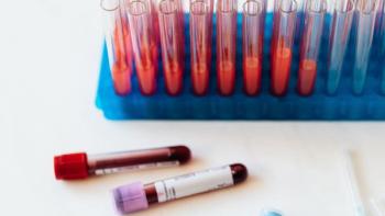 Studies show Signatera ctDNA testing may predict recurrence and guide treatment decisions in anal and rectal cancers: © Canva. 