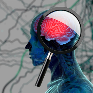 Image of the brain