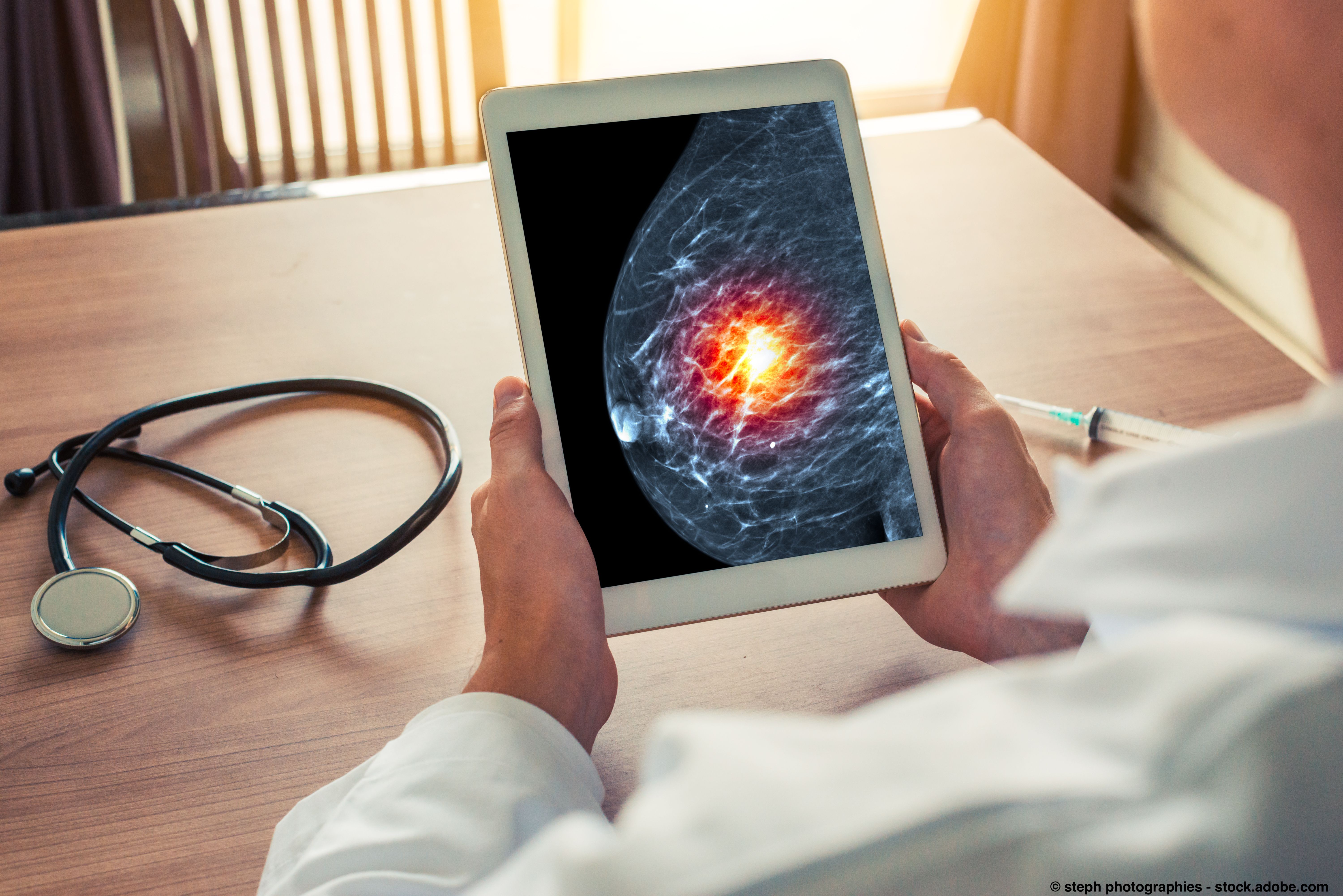 A doctor looking at a breast cancer scan.