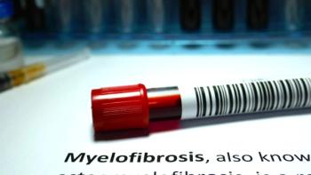 myelofibrosis