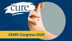 Postsurgical Opdivo Associated With Long-Term Activity in Melanoma