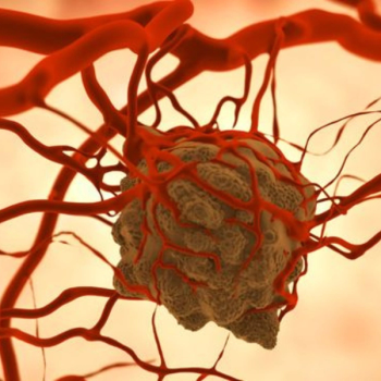 Illustration of giant cell.