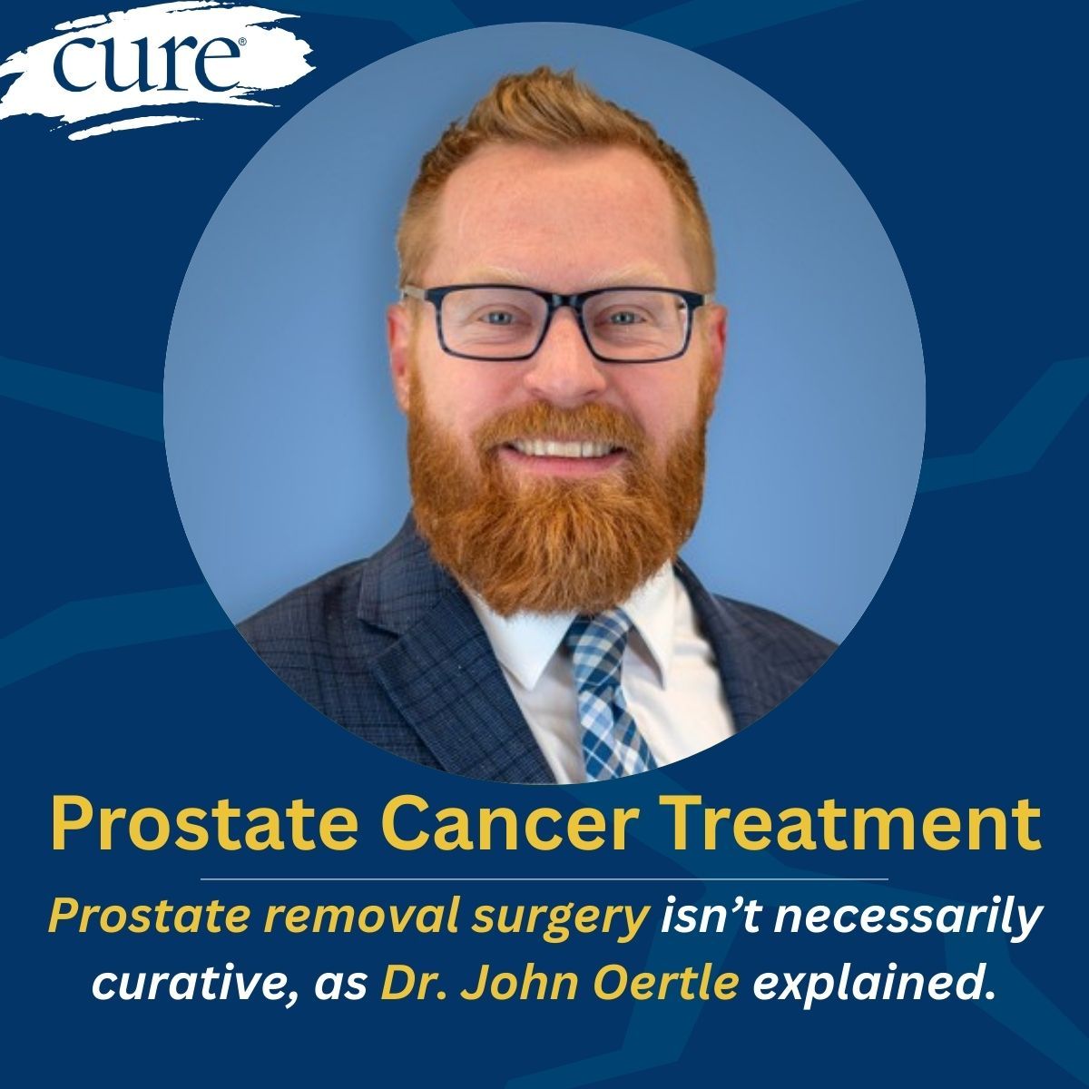 Prostatectomy Not Guaranteed to be Curative in Prostate Cancer