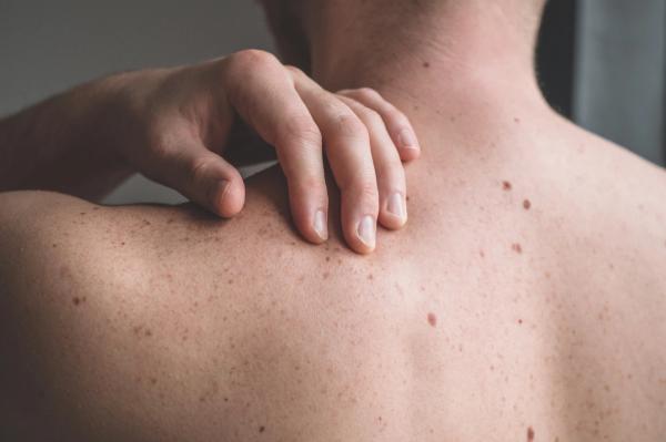 skin