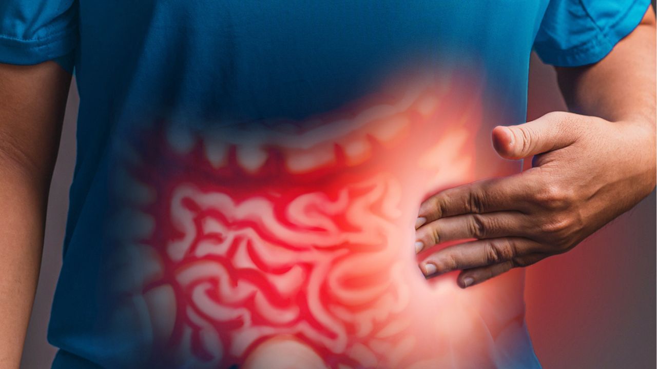 The FDA accepted a new drug application for zanzalintinib plus immunotherapy for some previously treated colorectal cancers: © stock.adobe.com.