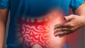 The FDA accepted a new drug application for zanzalintinib plus immunotherapy for some previously treated colorectal cancers: © stock.adobe.com.