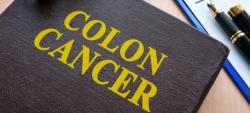 Presurgical Chemo May Not Improve Disease Control in Colon Cancer