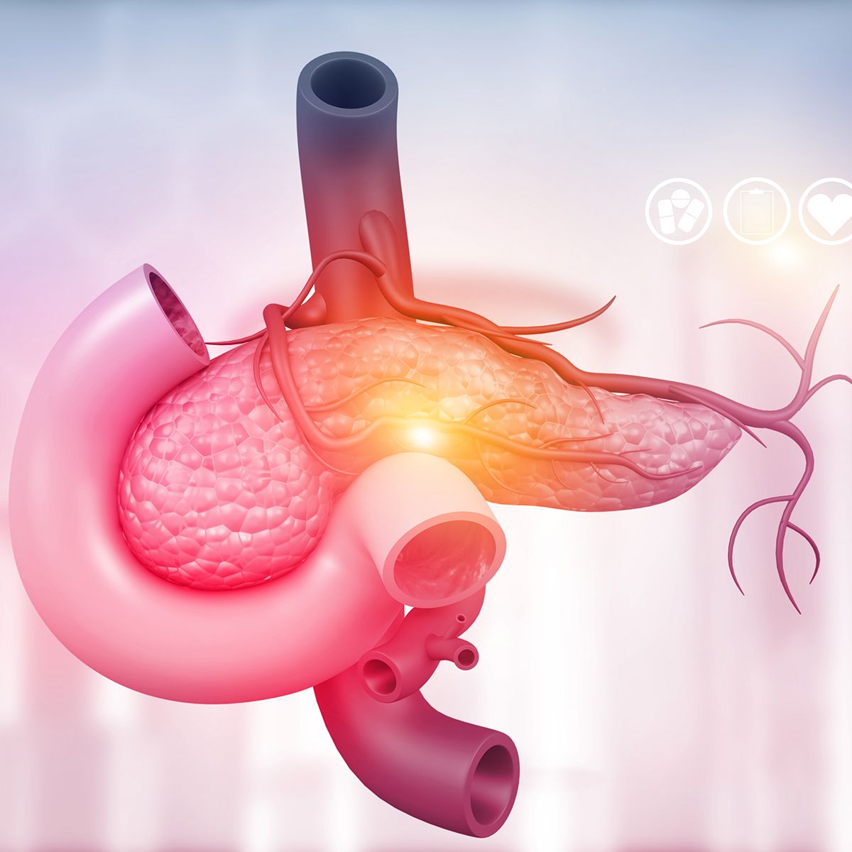 Daraxonrasib has received breakthrough therapy designation from the FDA for KRAS G12+, previously treated, metastatic PDAC: © stock.adobe.com.
