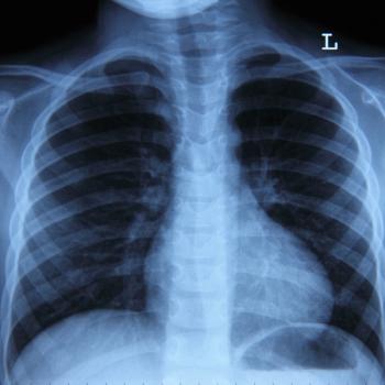 Illustratoin of lungs