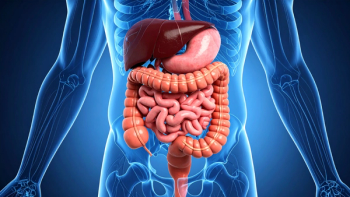 Photo of stomach.