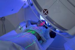 SBRT, CRT Radiation Therapies May Not Have Many Differences for NSCLC