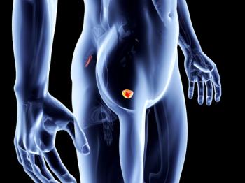 prostate scan