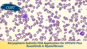 Image of Myelofibrosis