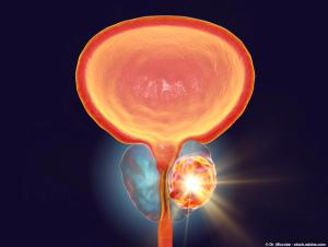 In prostate cancer, a high omega-3, low-omega-6 diet with fish oil led to a Ki-67 index decrease: Dr_microbe - stock.adobe.com