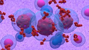 Tecvayli-Talvey Combo Cuts Myeloma Progression Risk by 89%