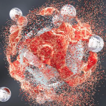 Image of tumor.