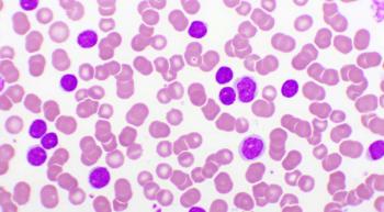 AML cells
