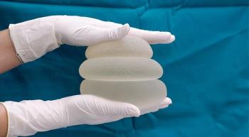 breast implants