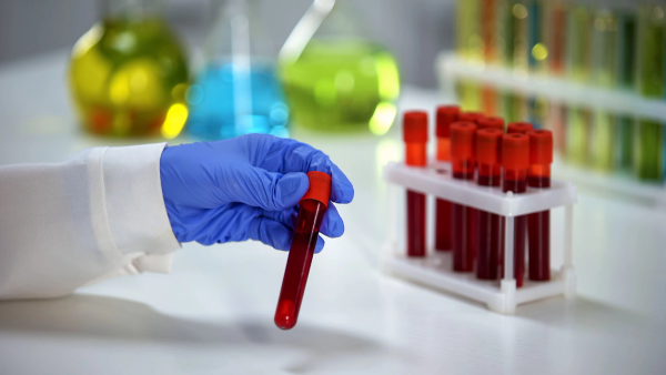 Supportive care alongside Jakafi helps myelofibrosis patients with anemia manage symptoms: © stock.adobe.com.