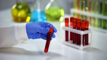 Supportive care alongside Jakafi helps myelofibrosis patients with anemia manage symptoms: © stock.adobe.com.