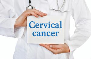 Image of "Cervical Cancer"
