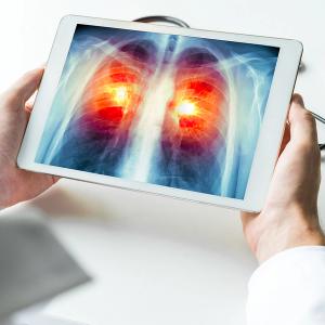 15% of U.S. Cancer Patients Are Active Smokers at Time of Diagnosis: © stock.adobe.com