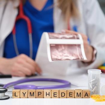 New results from a breast cancer-related lymphedema study show the importance of measuring fluid and body composition before treatment begins: © H_Ko - stock.adobe.com.