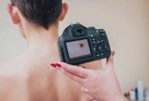 Photo of camera capturing skin.