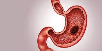 Illustration of stomach.
