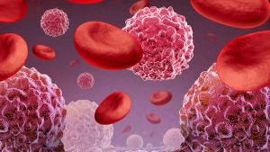 The NCCN Clinical Practice Guidelines in Oncology now include Besremi as a Category 1 preferred treatment option for some with high-risk essential thrombocythemia: © stock.adobe.com.