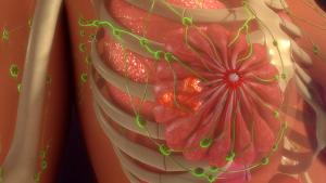 Image of breast.