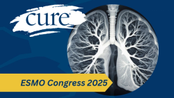 Alecensa Improves 4-Year Survival in Early ALK-Positive Lung Cancer