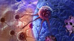 New CAR-T Therapy Safe and Efficacious for Non-Hodgkin Lymphoma 