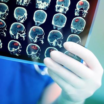 Image of brain.
