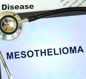 Mesothelioma in black text on a piece of paper with a stethoscope in sight.