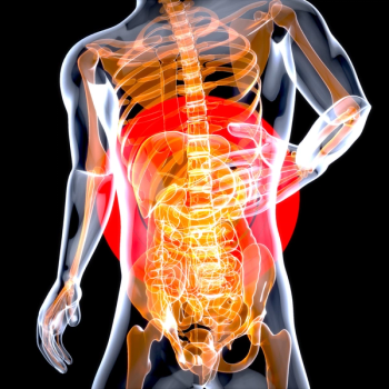 An illustration representing gastrointestinal stromal tumors, or GISTs.