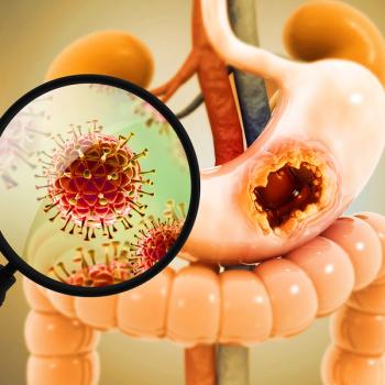 SIRT with 90Y resin microspheres led to durable disease control in patients with gastrointestinal stromal tumor liver metastases resistant to TKI therapy: © stock.adobe.com.