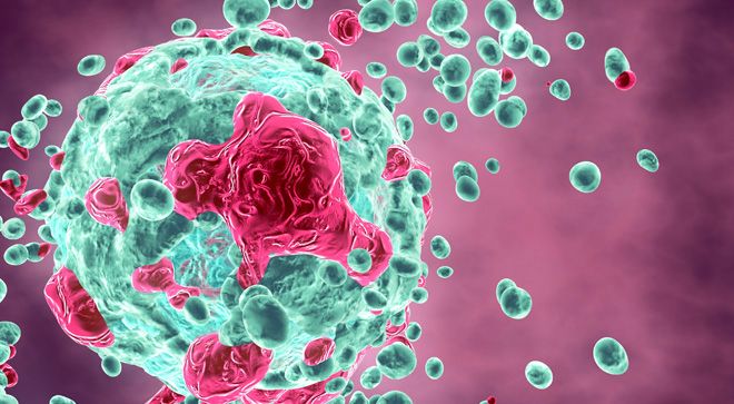 Why Melanoma May Need Treatment After Surgery 