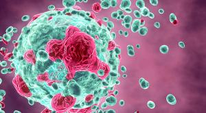 image of melanoma