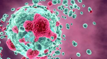 melanoma image