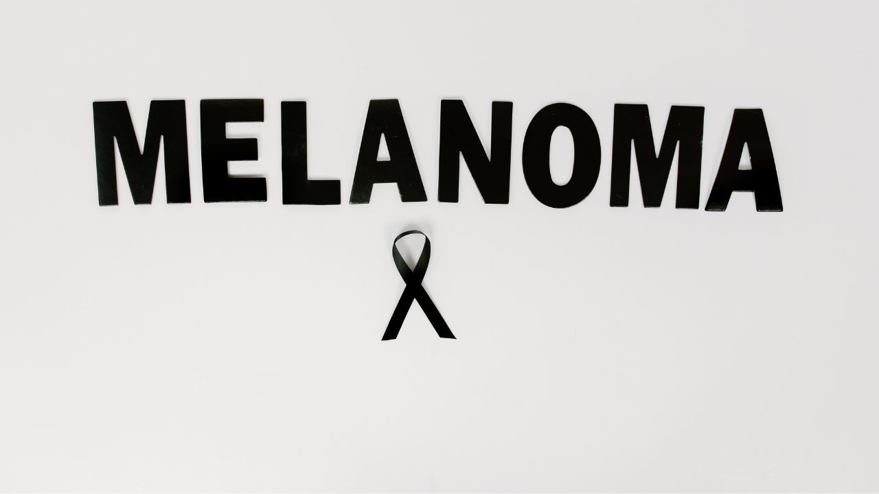 Nodular Melanoma Guide: Symptoms, Diagnosis and Treatment Options