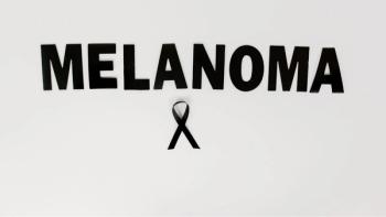 melanoma