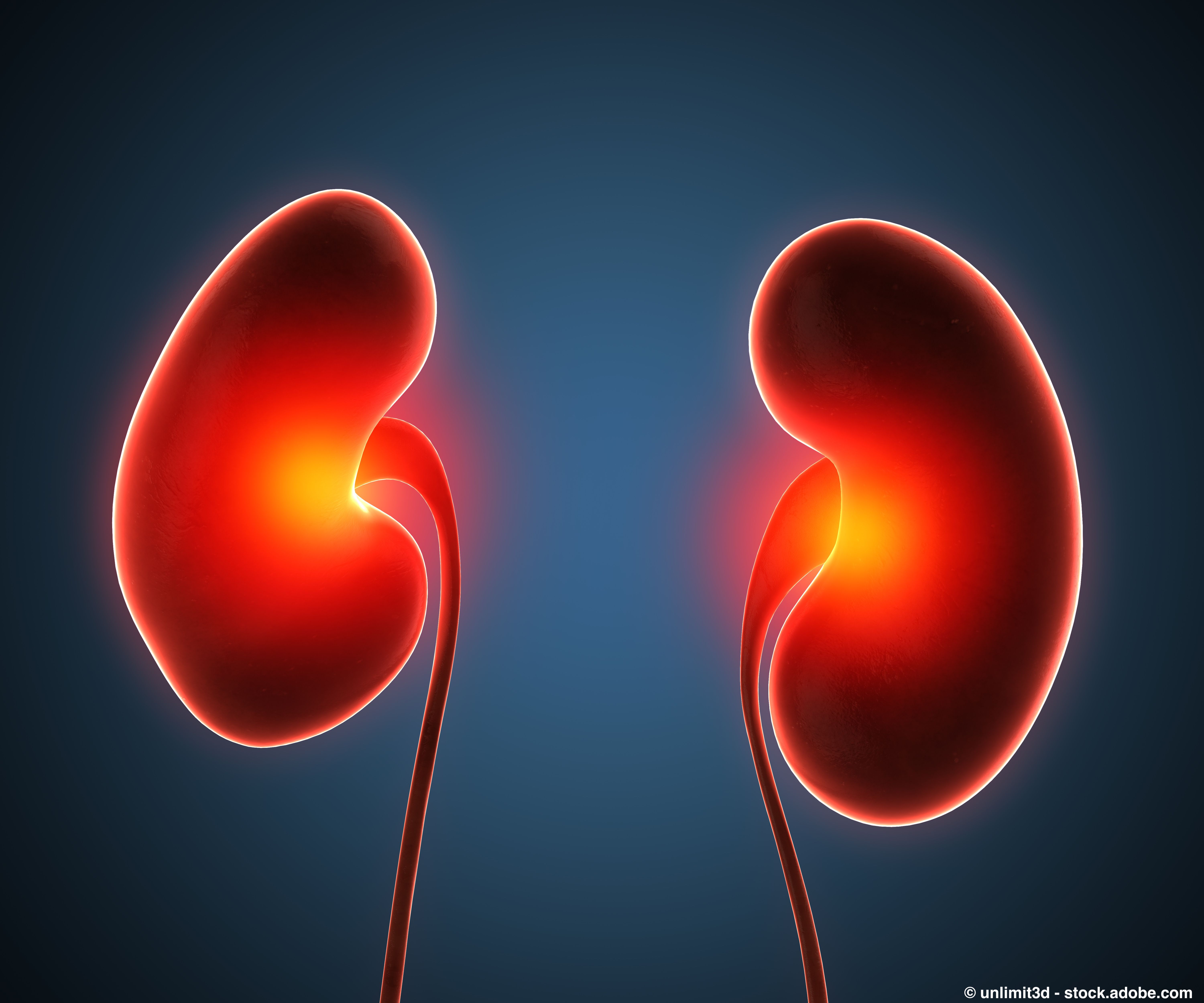 Among patients with clear cell renal cell carcinoma, improved responses were observed with Lenvima plus Welireg versus Keytruda plus Lenvima. © unlimit3d - stock.adobe.com