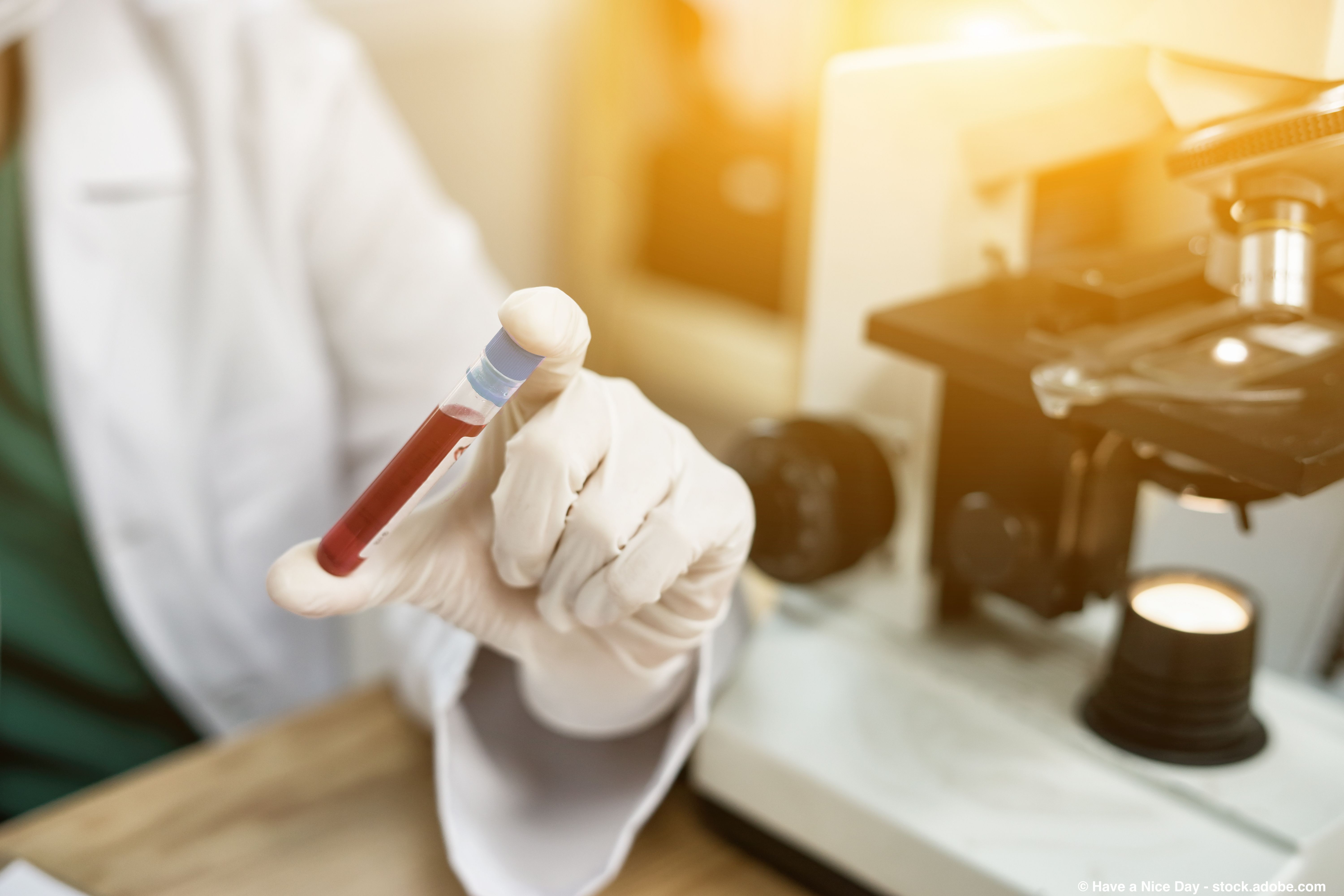 Image of blood-based test.