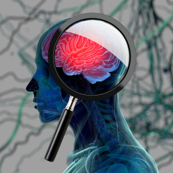 Illustration of brain.
