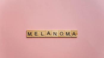 melanoma