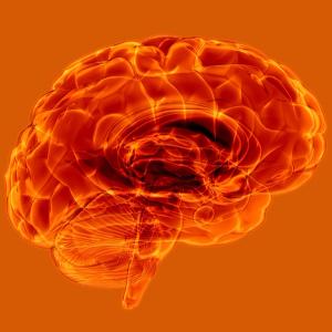 IDH Mutation Status May Guide Therapy in Patients With High-Risk Low-Grade Glioma