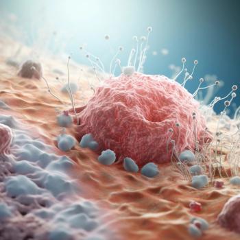 Image of melanoma