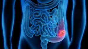 Illustration of body.